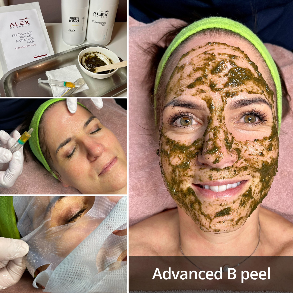 Advanced-B-peel_1